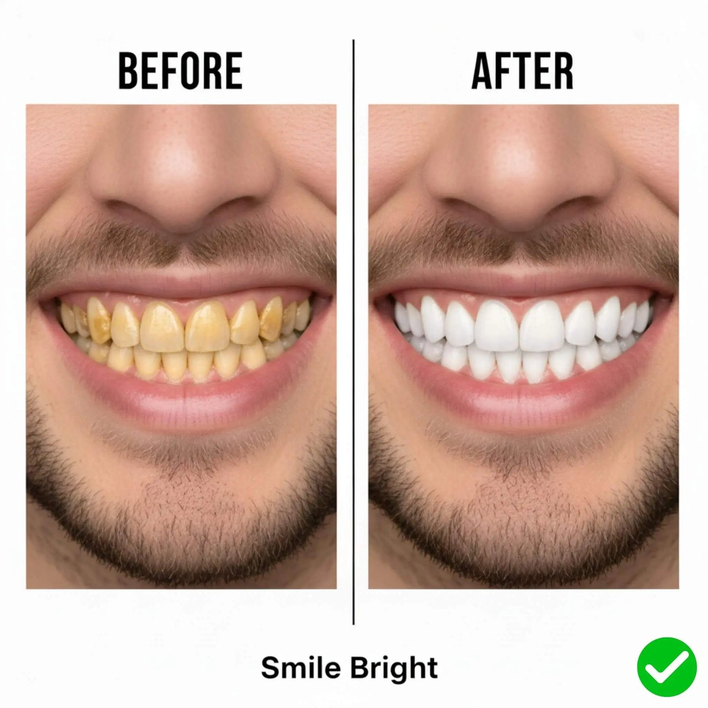 Smile Bright | Professional Teeth Whitening Drops